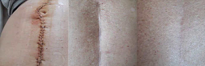 antiAging 4